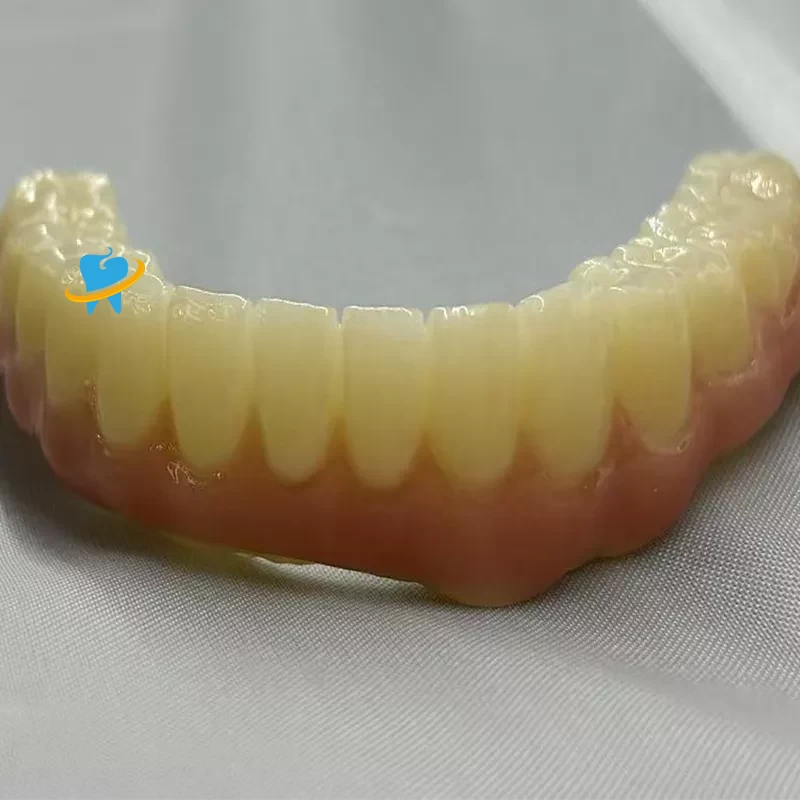 Advantages of Dental Implants