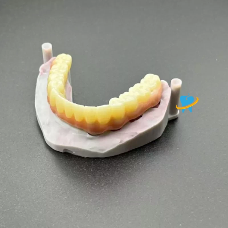 Advantages of Dental Implants