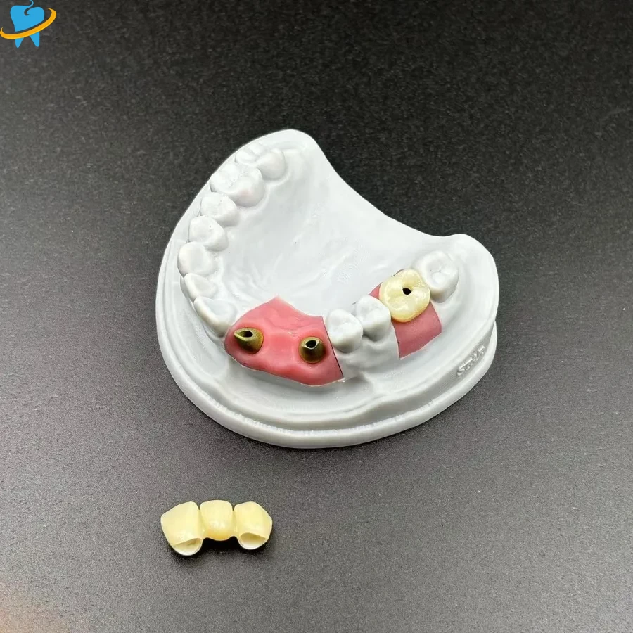 Realistic Full Zirconia Implant Crowns Manufacturer