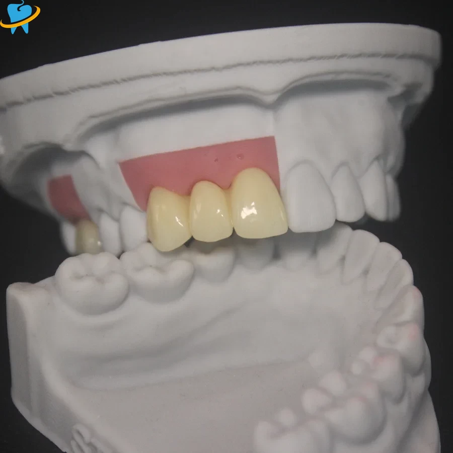 Realistic Full Zirconia Implant Crowns Manufacturer