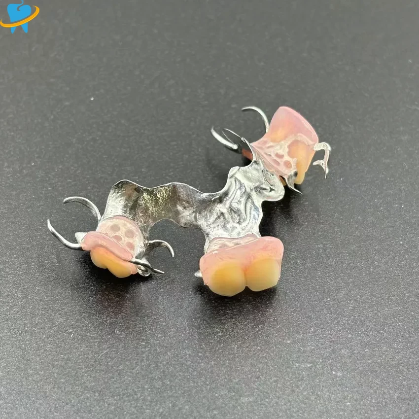 Precision-Cast Metal Partial Dentures Manufacturer