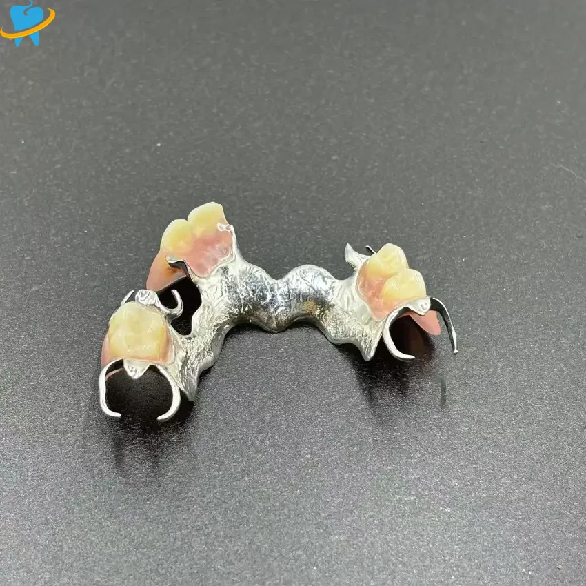 Precision-Cast Metal Partial Dentures Manufacturer