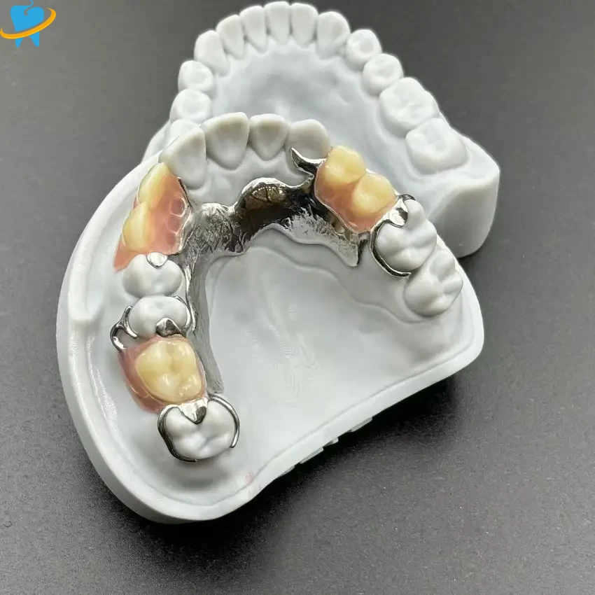 Precision-Cast Metal Partial Dentures Manufacturer