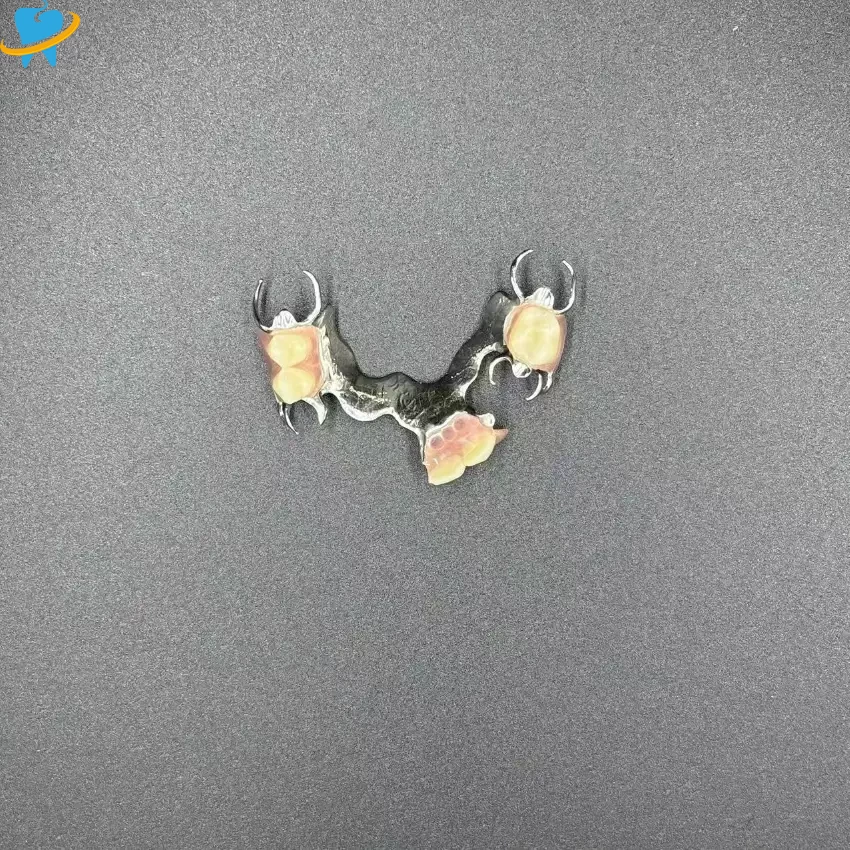 Precision-Cast Metal Partial Dentures Manufacturer