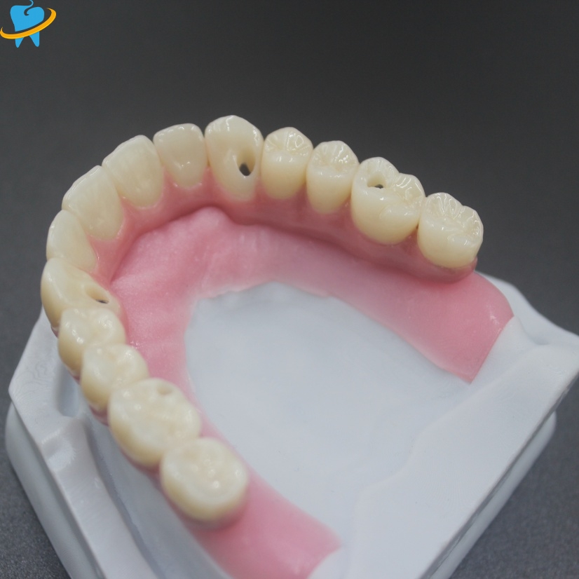 Custom High Quality Malo Bridge Manufacturer 