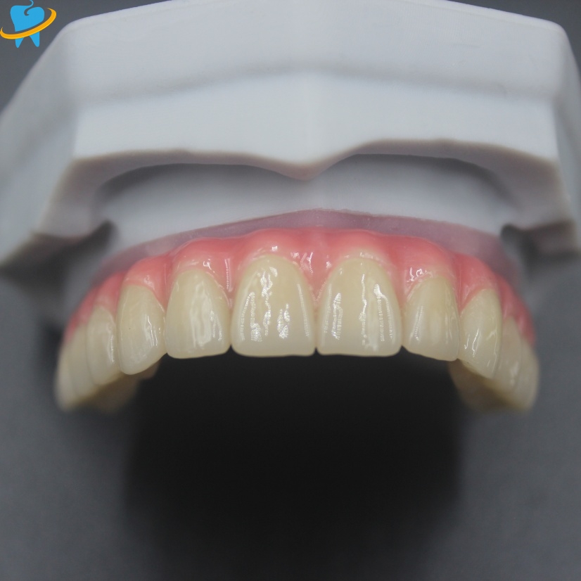Custom High Quality Malo Bridge Manufacturer 