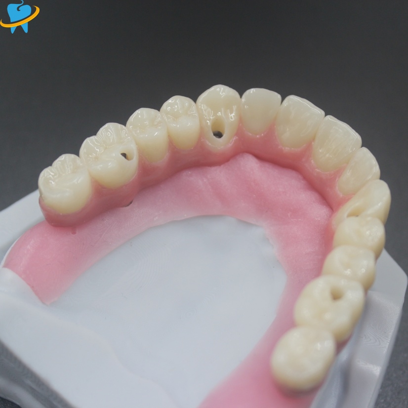 Malo Bridge Manufacturer 