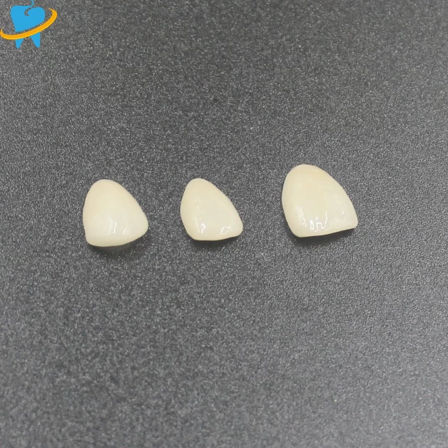 Custom E.max All-Ceramic Dental