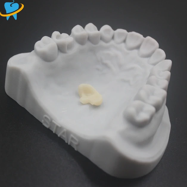 Custom E.max All-Ceramic Dental
