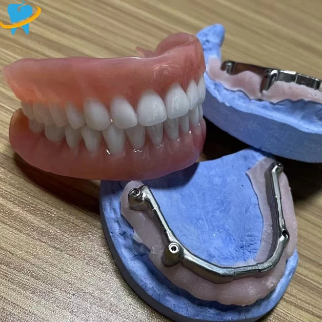 Best Custom Fixed Removable Restoration Lab