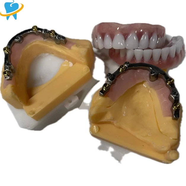 Best Custom Fixed Removable Restoration Lab