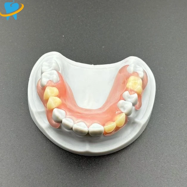 Custom Wholesale Removable-Valplast Manufacturer