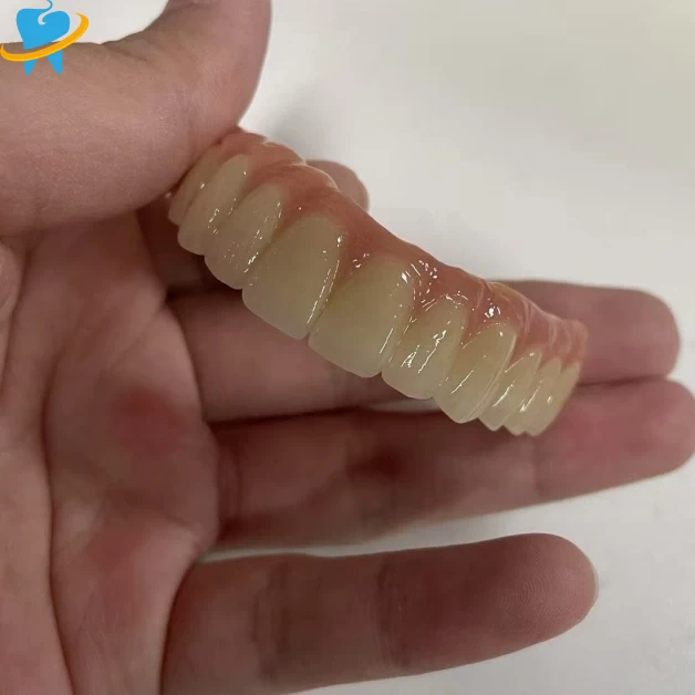 High-Performance Full Zirconia Crowns & Bridges