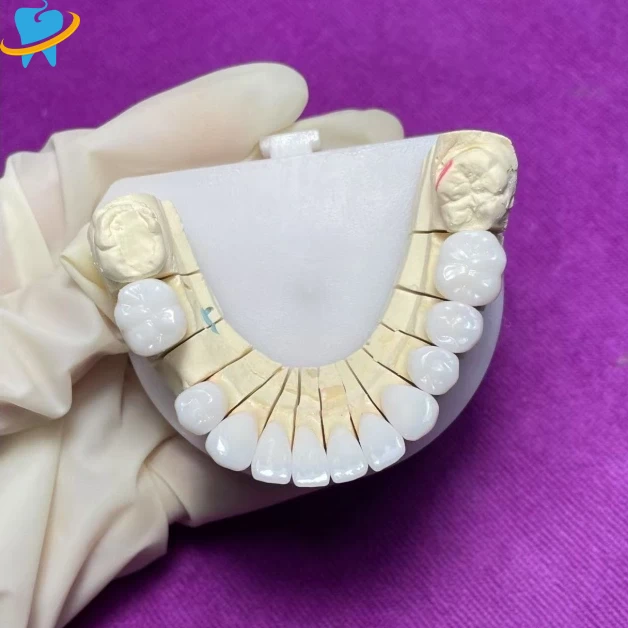 Full Zirconia