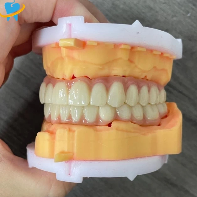 High-Performance Full Zirconia Crowns & Bridges