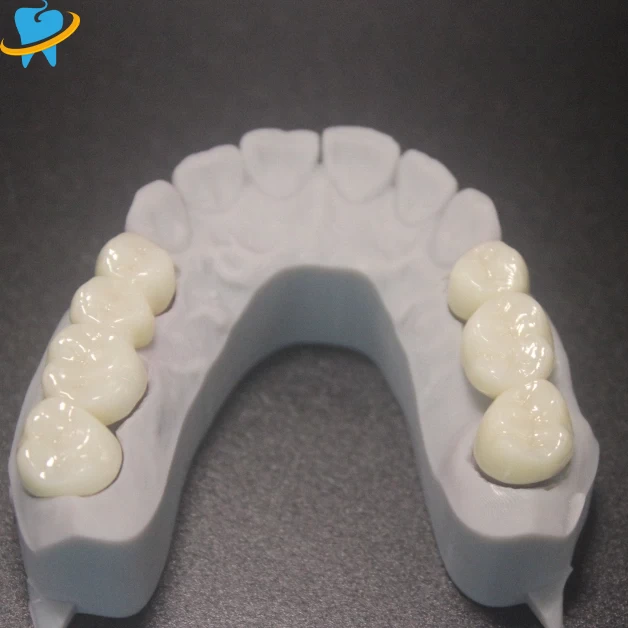 High-Performance Full Zirconia Crowns & Bridges