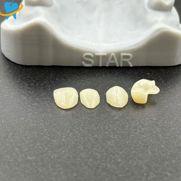Precision-Fit Restorations Inlay/Onlay Manufacturer