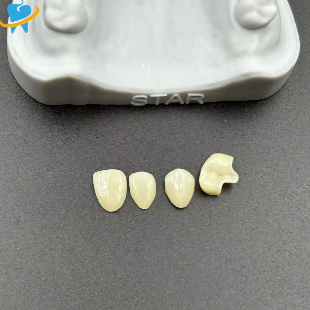 Precision-Fit Restorations Inlay/Onlay Manufacturer