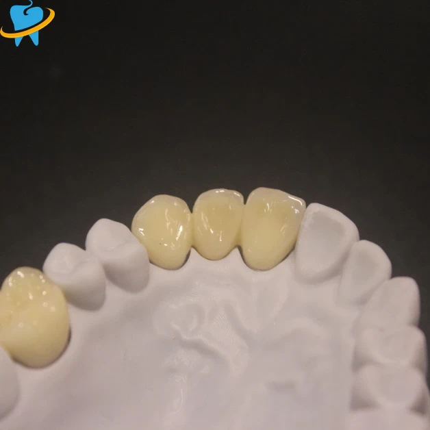 Premium Layered Zirconia Laboratory