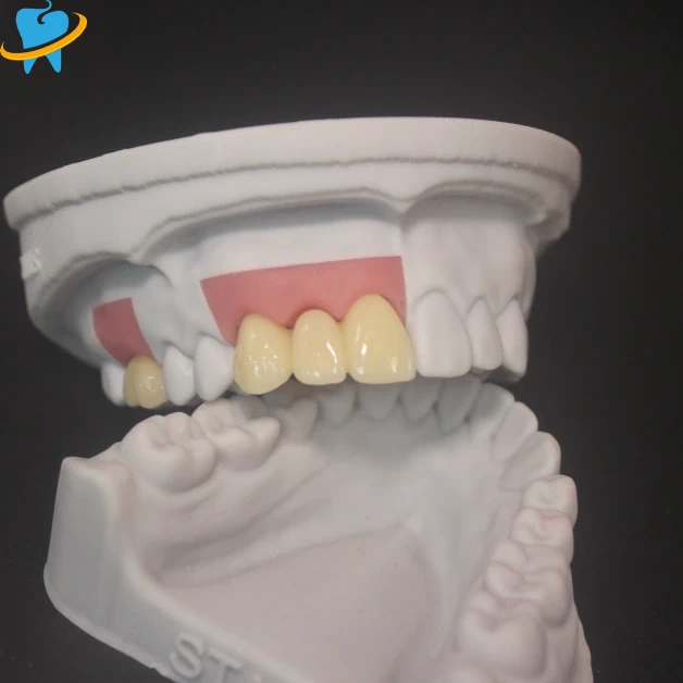 Premium Layered Zirconia Laboratory