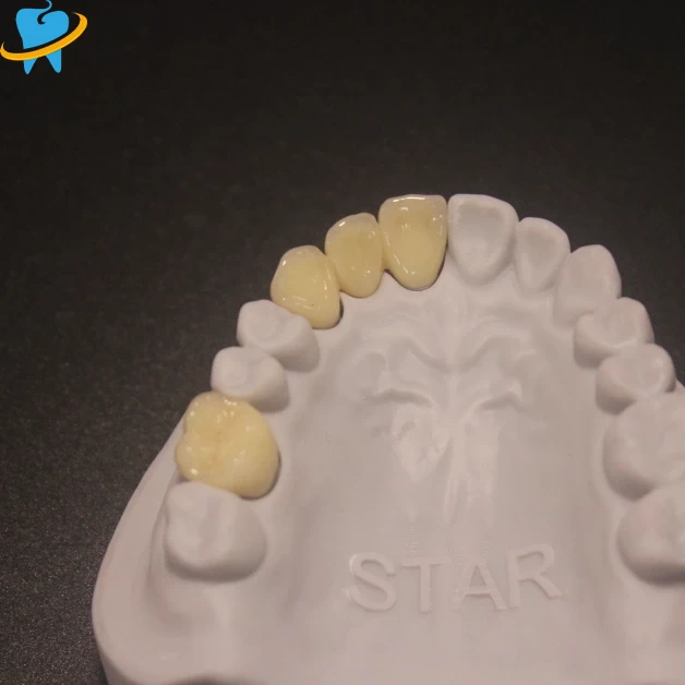 Premium Layered Zirconia Laboratory