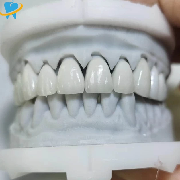 Premium Layered Zirconia Laboratory