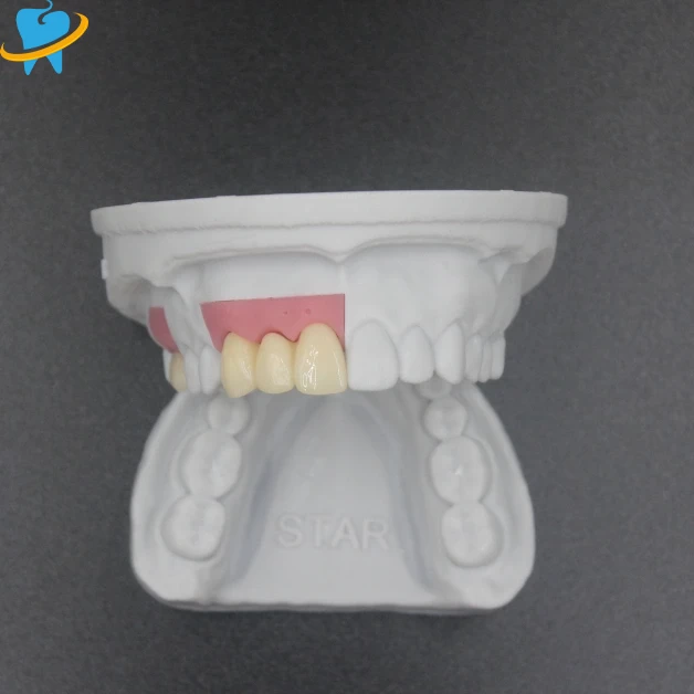 Premium Realistic Full Zirconia Implant Crowns Manufacturer
