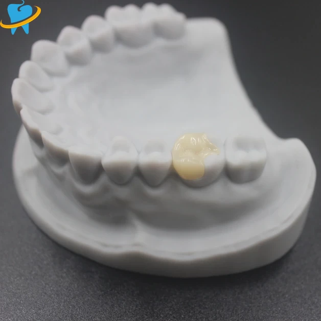 Boutique Dental Veneers Manufacturer