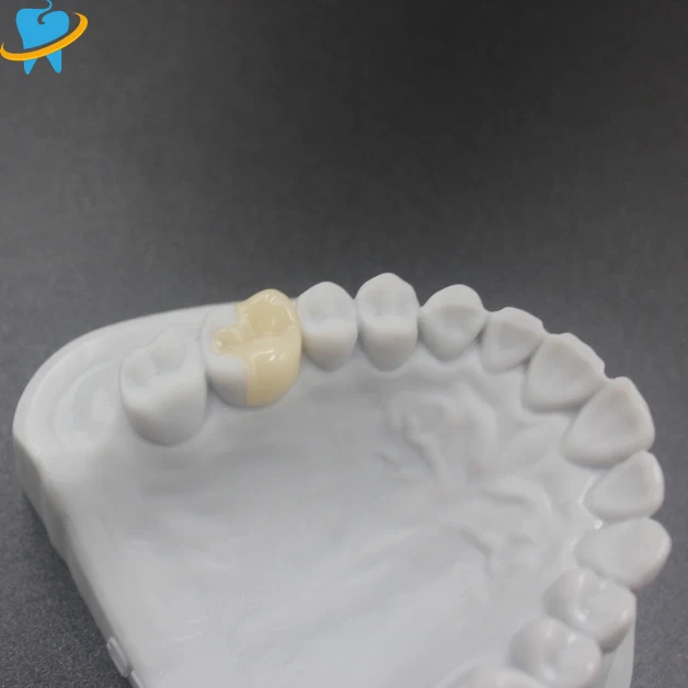 Boutique Dental Veneers Manufacturer