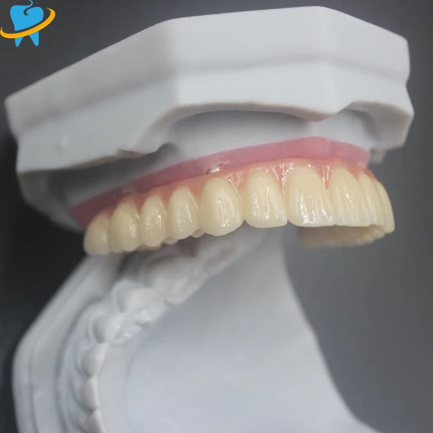 Superior Quality All on X Manufacturer