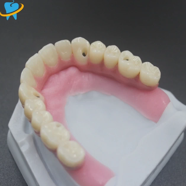 Superior Quality All on X Manufacturer