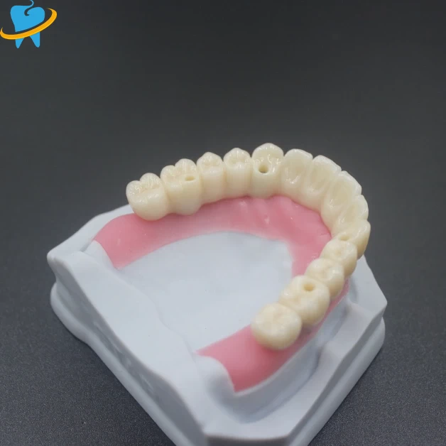 Superior Quality All on X Manufacturer
