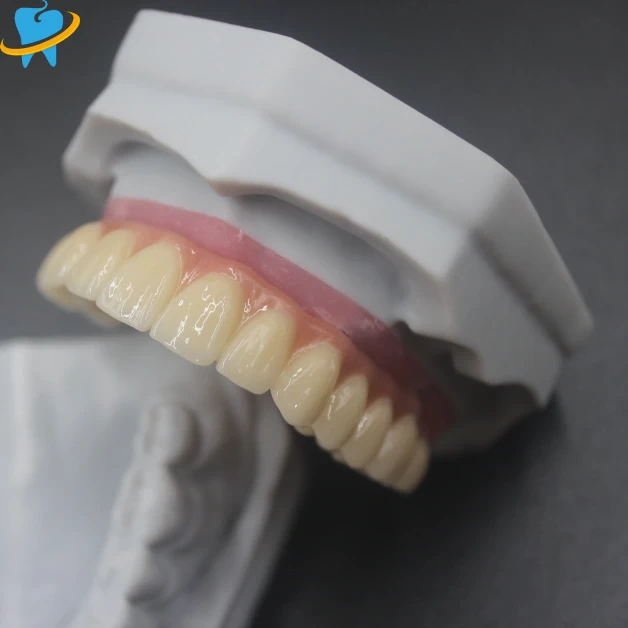 Superior Quality All on X Manufacturer