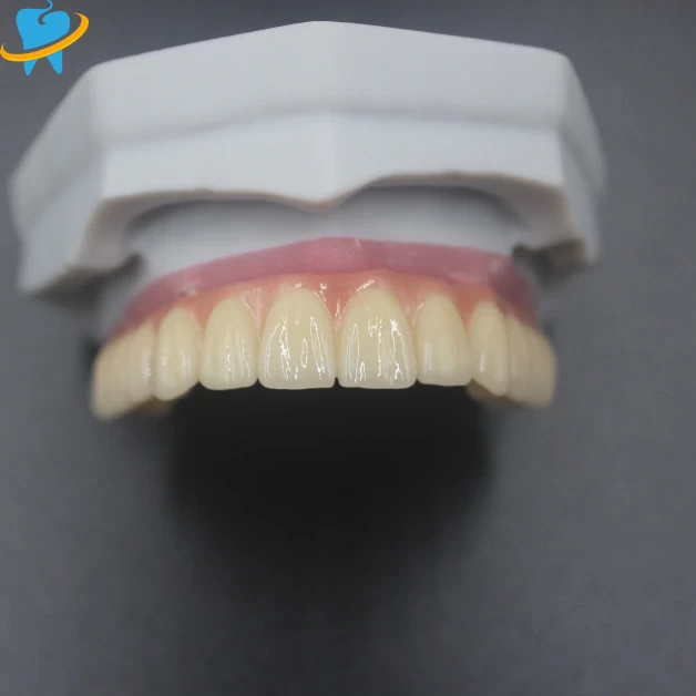 Precision Screw-Retained Implant Dental Lab
