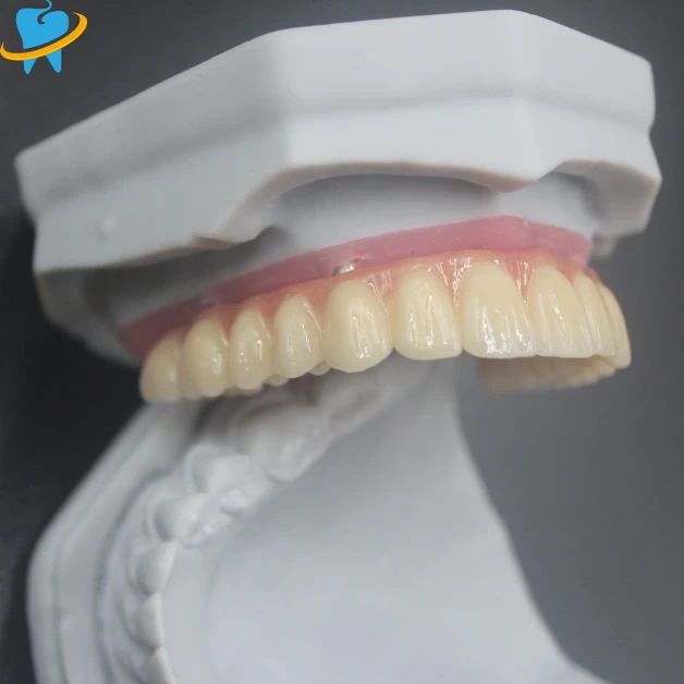 Advanced Screw-Retained Implant Dental Lab