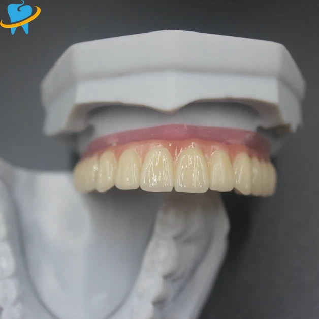 Advanced Screw-Retained Implant Dental Lab