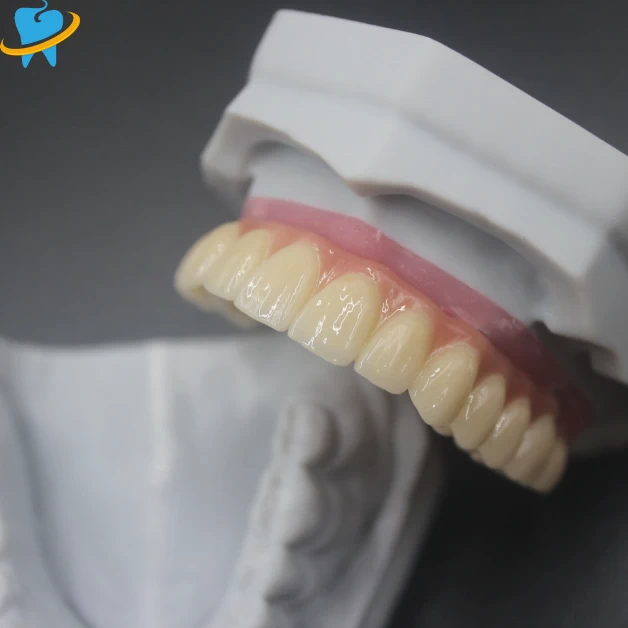 Advanced Screw-Retained Implant Dental Lab