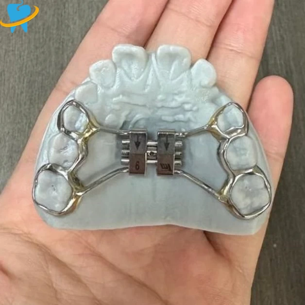Customized Personalized Dental Braces Lab