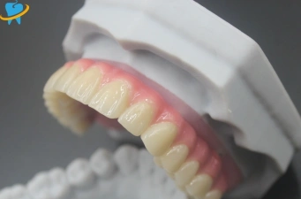 Porcelain Crowns, Full Crowns and Dental Implants: A Guide to Dental Practice Suppliers