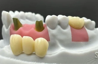 The Art & Science of Precision Dental Restorations