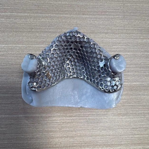 Custom Metal Frame for Dental Laboratory