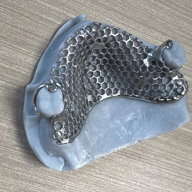 Custom Metal Frame for Dental Laboratory