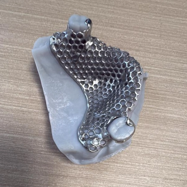 Custom Metal Frame for Dental Laboratory