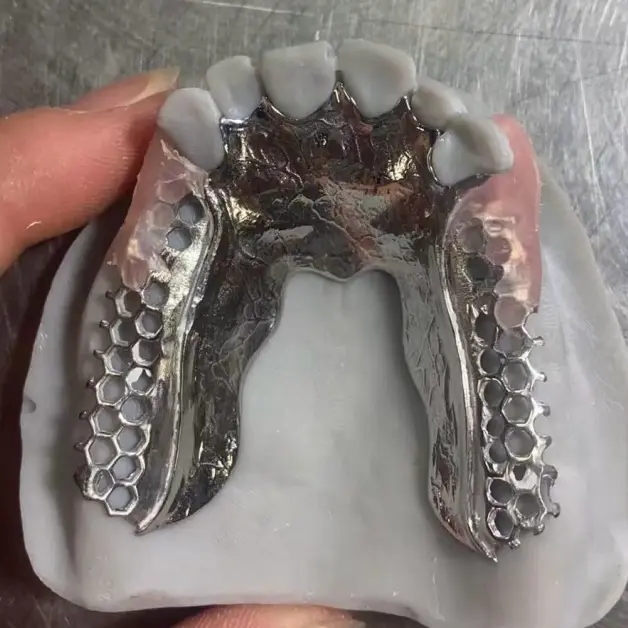 Dental Laboratory Outsourcing Metal Framework