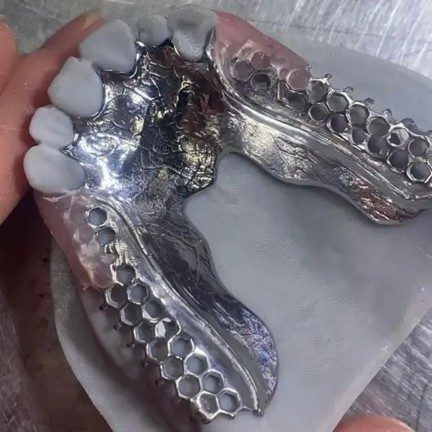Dental Laboratory Outsourcing Metal Framework