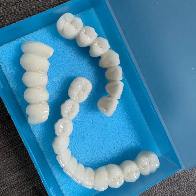High-quality Porcelain Crowns and Bridges for Long-lasting Beauty