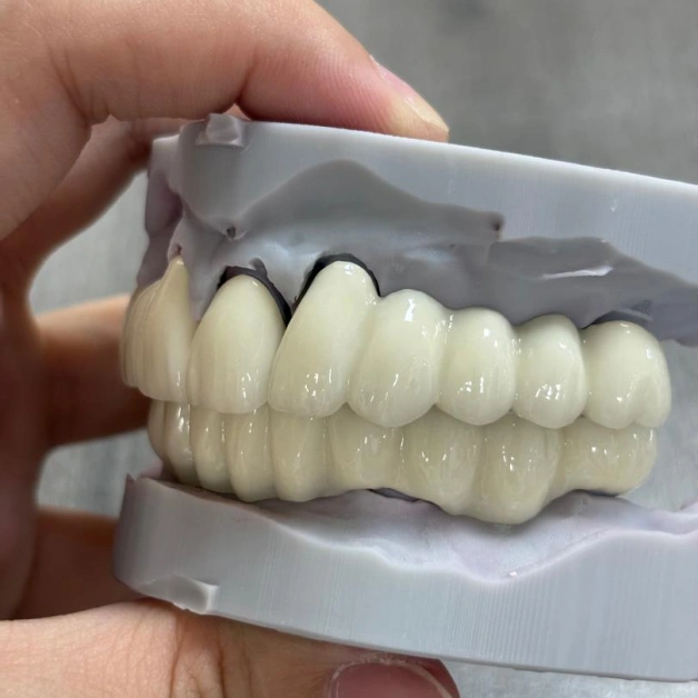 High-quality Porcelain Crowns and Bridges for Long-lasting Beauty